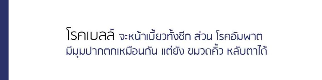 โรคใบหน้าเบี้ยว